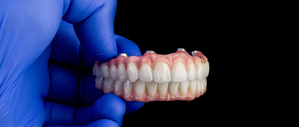 Dental prosthesis